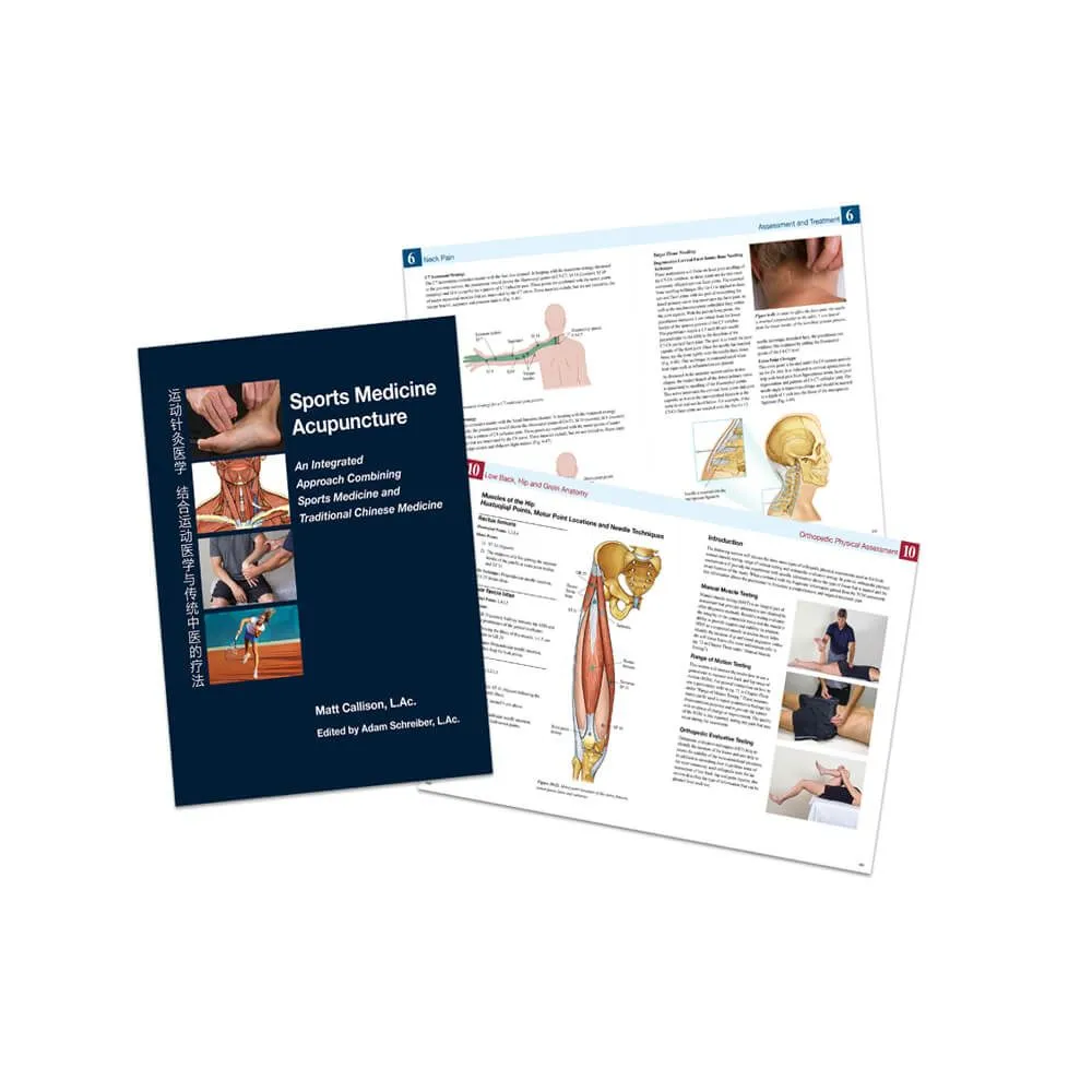 Sports Medicine Acupuncture