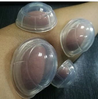Silicon Cozy Cupping Set, 12ct - Image 2