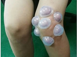 Silicon Cozy Cupping Set, 12ct - Image 4